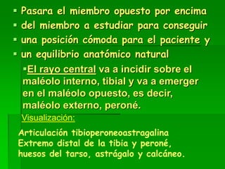  Pasara el miembro opuesto por encima
 del miembro a estudiar para conseguir
 una posición cómoda para el paciente y
 un equilibrio anatómico natural
El rayo central va a incidir sobre el
maléolo interno, tibial y va a emerger
en el maléolo opuesto, es decir,
maléolo externo, peroné.
Articulación tibioperoneoastragalina
Extremo distal de la tibia y peroné,
huesos del tarso, astrágalo y calcáneo.
Visualización:
 