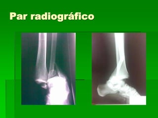 Par radiográfico
 