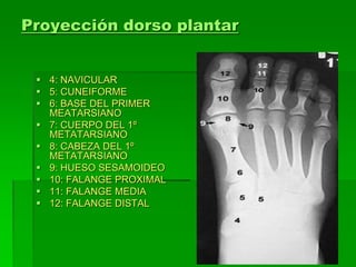 Proyección dorso plantar
 4: NAVICULAR
 5: CUNEIFORME
 6: BASE DEL PRIMER
MEATARSIANO
 7: CUERPO DEL 1º
METATARSIANO
 8: CABEZA DEL 1º
METATARSIANO
 9: HUESO SESAMOIDEO
 10: FALANGE PROXIMAL
 11: FALANGE MEDIA
 12: FALANGE DISTAL
 