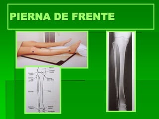 PIERNA DE FRENTE
 