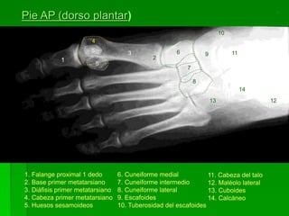 1. Falange proximal 1 dedo
2. Base primer metatarsiano
3. Diáfisis primer metatarsiano
4. Cabeza primer metatarsiano
5. Huesos sesamoideos
6. Cuneiforme medial
7. Cuneiforme intermedio
8. Cuneiforme lateral
9. Escafoides
10. Tuberosidad del escafoides
11. Cabeza del talo
12. Maléolo lateral
13. Cuboides
14. Calcáneo
Pie AP (dorso plantar)
1 2
3
4
6
7
8
9
10
11
1213
14
5
5
 