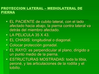 PROYECCION LATERAL – MEDIOLATERAL DE
PIERNA
 EL PACIENTE de cubito lateral, con el lado
afectado hacia abajo, la pierna contra lateral va
detrás del miembro afectado.
 LA PELICULA 35 X 43.
 EL CHASIS: longitudinal o diagonal.
 Colocar protección gonadal.
 EL RAYO: es perpendicular al plano, dirigido a
un punto medio de la pierna.
 ESTRUCTURAS MOSTRADAS: toda la tibia,
peroné, y las articulaciones de la rodilla y el
tobillo.
 