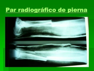 Par radiográfico de pierna
 