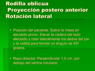 Rodilla oblicua
Proyección postero anterior
Rotación lateral
 Posición del paciente: Sobre la mesa en
decúbito prono. Elevar la cadera del lado
afectado y rotar lateralmente los dedos del pie
y la rodilla para formar un ángulo de 45º
grados.
 Rayo director: Perpendicular 1,5 cm. por
debajo del vértice rotuliano.
 