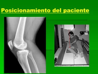 Posicionamiento del paciente
 