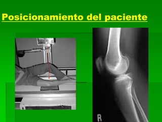 Posicionamiento del paciente
 