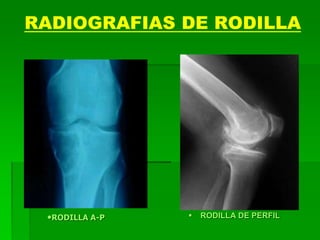RADIOGRAFIAS DE RODILLA
 RODILLA DE PERFIL•RODILLA A-P
 