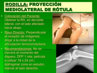 RODILLA: PROYECCIÓN
MEDIOLATERAL DE RÓTULA
 Colocación del Paciente:
Obtener la RX, en decúbito
lateral, con el lado afectado
hacia abajo.
 Rayo Director: Perpendicular
al receptor de imágenes;
dirigir a la mitad de la
articulación femororrotuliana.
 Recomendaciones: No se
moverá al momento del
disparo; DFP 1 mts; película
a utilizar 18 x 24 cm.;
diafragmar zona en estudio;
marcar el lado derecho.
 