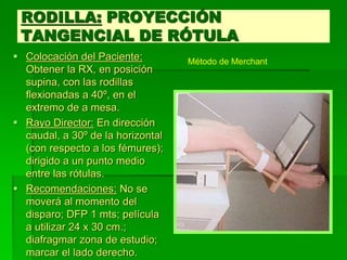 RODILLA: PROYECCIÓN
TANGENCIAL DE RÓTULA
 Colocación del Paciente:
Obtener la RX, en posición
supina, con las rodillas
flexionadas a 40º, en el
extremo de a mesa.
 Rayo Director: En dirección
caudal, a 30º de la horizontal
(con respecto a los fémures);
dirigido a un punto medio
entre las rótulas.
 Recomendaciones: No se
moverá al momento del
disparo; DFP 1 mts; película
a utilizar 24 x 30 cm.;
diafragmar zona de estudio;
marcar el lado derecho.
Método de Merchant
 