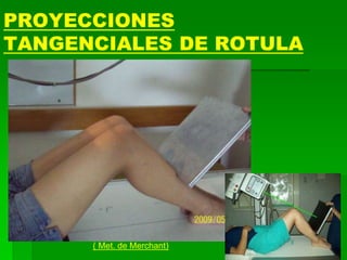 PROYECCIONES
TANGENCIALES DE ROTULA
( Met. de Merchant)
 