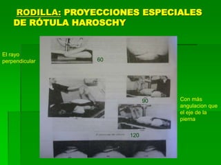 RODILLA: PROYECCIONES ESPECIALES
DE RÓTULA HAROSCHY
60
90
120
El rayo
perpendicular
Con más
angulacion que
el eje de la
pierna
 