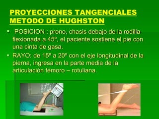 PROYECCIONES TANGENCIALES
METODO DE HUGHSTON
 POSICION : prono, chasis debajo de la rodilla
flexionada a 45º, el paciente sostiene el pie con
una cinta de gasa.
 RAYO: de 15º a 20º con el eje longitudinal de la
pierna, ingresa en la parte media de la
articulación fémoro – rotuliana.
 