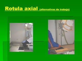 Rotula axial (alternativas de trabajo)
 
