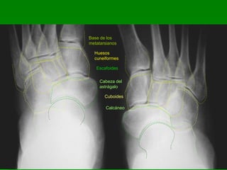Base de los
metatarsianos
Huesos
cuneiformes
Escafoides
Cabeza del
astrágalo
Cuboides
Calcáneo
 