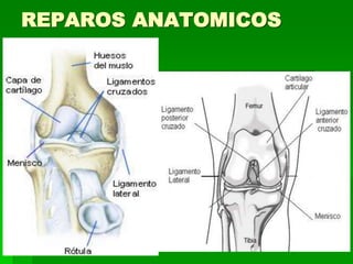 REPAROS ANATOMICOS
 
