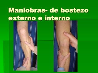 Maniobras- de bostezo
externo e interno
 