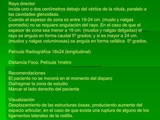 Rayo director
incide uno o dos centímetros debajo del vértice de la rótula, paralelo a
las cavidades glenoideas.
Cuando el espesor de zona es entre 19-24 cm. (muslo y nalgas
promedio) no se requiere angulación del rayo. En el caso de que el
espesor de zona sea menor a 19 cm. (muslos y nalgas delgadas) el
rayo se angula en forma caudal 5º grados; y si es mayor a 24 cm.
(muslos y nalgas voluminosas) se angula en forma cefálica 5º grados.
Película Radiográfica 18x24 (longitudinal)
Distancia Foco. Película 1metro
Recomendaciones
El paciente no se moverá en el momento del disparo
Diafragmar la zona de estudio
Marcar el lado derecho del paciente
Visualización
Desplazamiento de las estructuras óseas, produciendo aumento del
espacio articular, en el caso de que exista una ruptura de alguno de los
ligamentos laterales de la rodilla.
 