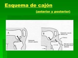 Esquema de cajón
(anterior y posterior)
 