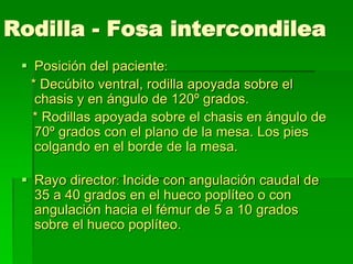 Rodilla - Fosa intercondilea
 Posición del paciente:
* Decúbito ventral, rodilla apoyada sobre el
chasis y en ángulo de 120º grados.
* Rodillas apoyada sobre el chasis en ángulo de
70º grados con el plano de la mesa. Los pies
colgando en el borde de la mesa.
 Rayo director: Incide con angulación caudal de
35 a 40 grados en el hueco poplíteo o con
angulación hacia el fémur de 5 a 10 grados
sobre el hueco poplíteo.
 