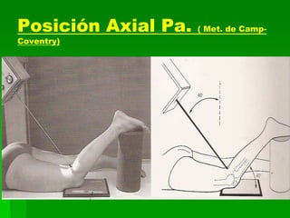 Posición Axial Pa. ( Met. de Camp-
Coventry)
 