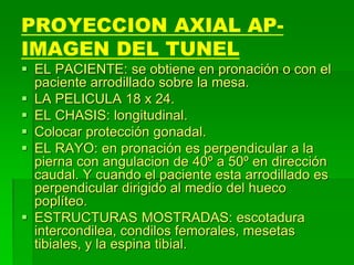 PROYECCION AXIAL AP-
IMAGEN DEL TUNEL
 EL PACIENTE: se obtiene en pronación o con el
paciente arrodillado sobre la mesa.
 LA PELICULA 18 x 24.
 EL CHASIS: longitudinal.
 Colocar protección gonadal.
 EL RAYO: en pronación es perpendicular a la
pierna con angulacion de 40º a 50º en dirección
caudal. Y cuando el paciente esta arrodillado es
perpendicular dirigido al medio del hueco
poplíteo.
 ESTRUCTURAS MOSTRADAS: escotadura
intercondilea, condilos femorales, mesetas
tibiales, y la espina tibial.
 