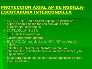PROYECCION AXIAL AP DE RODILLA-
ESCOTADURA INTERCONDILEA
 EL PACIENTE: en posición supina. Se coloca un
soporte debajo de las rodillas que van a estar
parcialmente flexionadas
 LA PELICULA 18 x 24.
 EL CHASIS: transversal
 Colocar protección gonadal.
 EL RAYO: Con angulacion de 40º a 45º en dirección
cefálica.
 ESTRUCTURAS MOSTRADAS: escotadura
intercondilea, condilos femorales, mesetas tibiales, y la
espina tibial.
 Sirve para buscar signos de proceso patológicos óseos
o cartilaginosos.
 