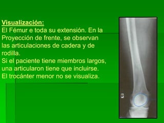 Visualización:
El Fémur e toda su extensión. En la
Proyección de frente, se observan
las articulaciones de cadera y de
rodilla.
Si el paciente tiene miembros largos,
una articularon tiene que incluirse.
El trocánter menor no se visualiza.
 