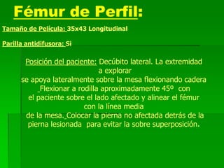 Fémur de Perfil:
Tamaño de Película: 35x43 Longitudinal
Parilla antidifusora: Si
Posición del paciente: Decúbito lateral. La extremidad
a explorar
se apoya lateralmente sobre la mesa flexionando cadera
Flexionar a rodilla aproximadamente 45º con
el paciente sobre el lado afectado y alinear el fémur
con la línea media
de la mesa. Colocar la pierna no afectada detrás de la
pierna lesionada para evitar la sobre superposición.
 