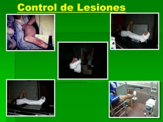 Control de Lesiones
 