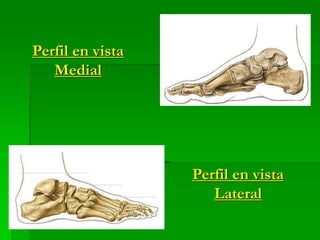 Perfil en vista
Medial
Perfil en vista
Lateral
 
