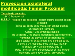 Proyección axiolateral
modificada: Fémur Proximal
Tamaño de película:
24x30 Transversal
D.F.P: 1 mPosición del paciente: Posición supina colocar el lado
afectado
cerca del borde de la mesa, con ambas piernas
en extensión completa.
Colocar una almohada debajo
de la cabeza y los brazos flexionados sobre del tórax.
Mantener las piernas en posición neutra
abajo colocar el chasis sobre una bandeja bucky
a unos 5 cm mas debajo de la mesa, inclinar
el chasis 15º y alinearlo para que la
parte anterior este perpendicular al rayo central
del chasis con el rayo central proyectado.
 