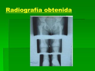 Radiografía obtenida
 
