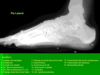 Pie Lateral
1
2
34
5
6
7
8
9
10
11
12
13
14
15
1. Cabeza del astrágalo
2. Escafoides
3. Cuneiforme medial
4. Art. Tarsometatarsiana I
5. Art. Tarsometatarsiana II y III
6. Falange distal del primer dedo
7. Falange proximal del primer dedo
8. Sesamoideos
9. Sustentaculum tali
10. Articulación subtalar
11. Cuboides
12. Art. calcáneocuboidea
13. Tuberosidad del quinto metatarsiano
14. Tuberosidad del calcáneo
15. Almohadilla plantar
Identificar:
 