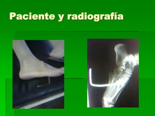 Paciente y radiografía
 
