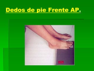 Dedos de pie Frente AP.
 