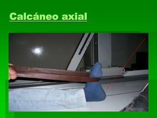 Calcáneo axial
 