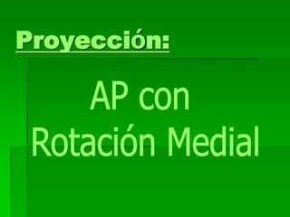Proyección:
 