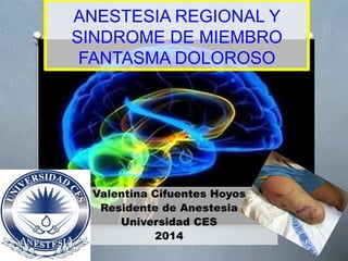 ANESTESIA REGIONAL Y 
SINDROME DE MIEMBRO 
FANTASMA DOLOROSO 
Valentina Cifuentes Hoyos 
Residente de Anestesia 
Universidad CES 
2014 
 