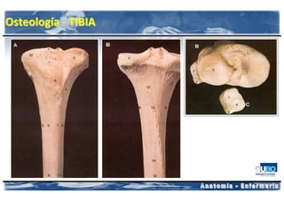 Osteología - TIBIA
 