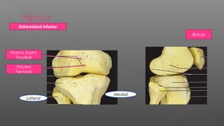 Extremidad Inferior
                                  Rotula



Hueco Supra
  Troclear

  Tróclea
  Femoral




                         Medial
      Lateral
 
