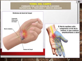 83
TÚNEL DEL CARPO
FORMADO POR LOS MÚSCULOS FLEXORES
SUPERFICIAL Y PROFUNDO Y NERVIO MEDIANO
 