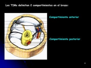 Los TIMs delimitan 2 compartimientos en el brazo:
Compartimiento anterior
Compartimiento posterior
38
 