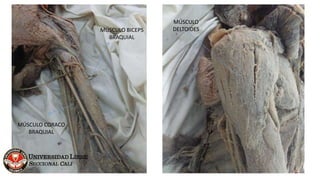 MÚSCULO
DELTOIDESMÚSCULO BICEPS
BRAQUIAL
MÚSCULO CORACO
BRAQUIAL
 