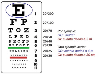 Por ejemplo:
OD: 20/200
OI: cuenta dedos a 2 m
Otro ejemplo sería:
OD: cuenta dedos a 4 m
OI: cuenta dedos a 30 cm
 