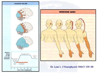 Dr. Leao´s  J Neurophysiol 1944;7: 359 -90 