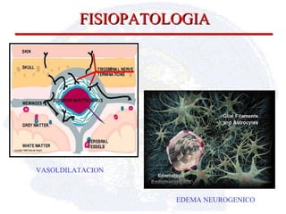 FISIOPATOLOGIA VASOLDILATACION EDEMA NEUROGENICO 