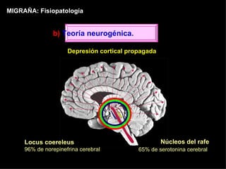 MIGRAÑA: Fisiopatología Locus coereleus 96% de norepinefrina cerebral Núcleos del rafe 65% de serotonina cerebral   Depresión cortical propagada b)  Teoría neurogénica. 