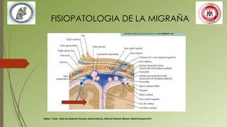 FISIOPATOLOGIA DE LA MIGRAÑA
Netter , Frank , Atlas de Anatomia Humana, Quinta Edicion, Editorial Elsevier Masson, Madrid España,2011.
 