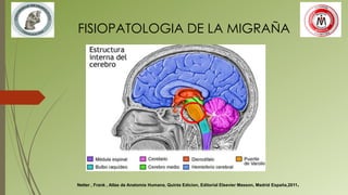 FISIOPATOLOGIA DE LA MIGRAÑA
Netter , Frank , Atlas de Anatomia Humana, Quinta Edicion, Editorial Elsevier Masson, Madrid España,2011.
 