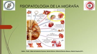 FISIOPATOLOGIA DE LA MIGRAÑA
Netter , Frank , Atlas de Anatomia Humana, Quinta Edicion, Editorial Elsevier Masson, Madrid España,2011.
 